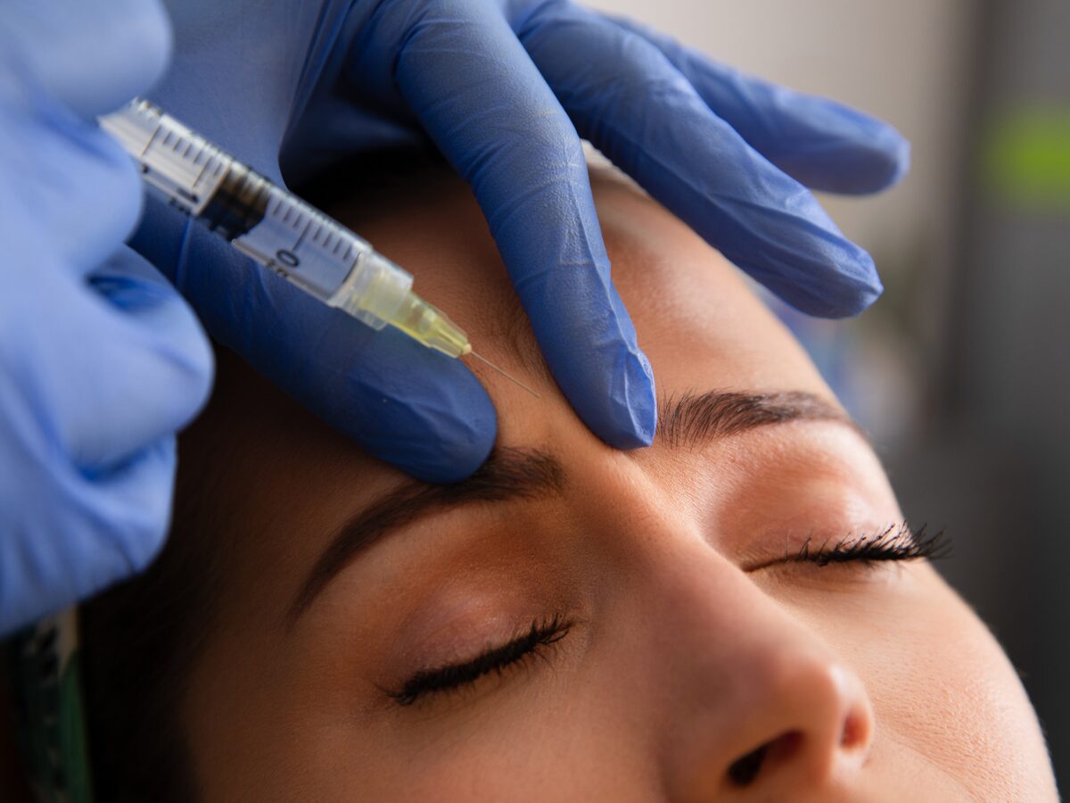 Behandlerin mit blauen Handschuhen setzt eine feine Injektion zwischen die Augenbrauen einer Patientin mit geschlossenen Augen.